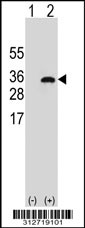 Western blot analysis of his-tag GSTM5 (arrow) using his tag antibody. 293T cell lysates (2 ug/lane) either nontransfected (Lane 1) or transiently transfected with the GSTM5 gene