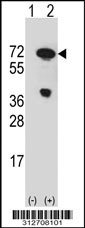 Western blot analysis of his-tag GLB1 (arrow) using his tag antibody. 293T cell lysates (2 ug/lane) either nontransfected (Lane 1) or transiently transfected with the GLB1 gene