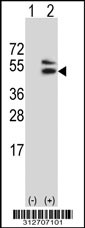 Western blot analysis of his-tag GCNT2 (arrow) using his tag antibody. 293T cell lysates (2 ug/lane) either nontransfected (Lane 1) or transiently transfected with the LGALS22 gene