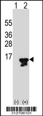 Western blot analysis of his-tag GCHFR (arrow) using his tag antibody. 293T cell lysates (2 ug/lane) either nontransfected (Lane 1) or transiently transfected with the GCHFR gene