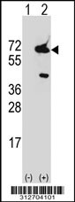 Western blot analysis of his-tag GBP1 (arrow) using his tag antibody. 293T cell lysates (2 ug/lane) either nontransfected (Lane 1) or transiently transfected with the GBP1 gene