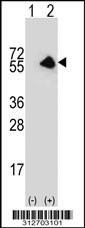Western blot analysis of his-tag GAD2 (arrow) using his tag antibody. 293T cell lysates (2 ug/lane) either nontransfected (Lane 1) or transiently transfected with the GAD2 gene