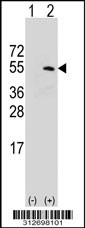 Western blot analysis of his-tag FNTA (arrow) using his tag antibody. 293T cell lysates (2 ug/lane) either nontransfected (Lane 1) or transiently transfected with the FNTA gene