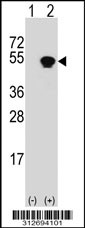 Western blot analysis of his-tag FDXR (arrow) using his tag antibody. 293T cell lysates (2 ug/lane) either nontransfected (Lane 1) or transiently transfected with the FDXR gene