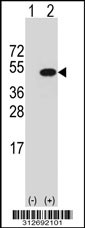 Western blot analysis of his-tag FAH (arrow) using his tag antibody. 293T cell lysates (2 ug/lane) either nontransfected (Lane 1) or transiently transfected with the FAH gene