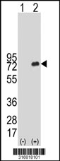 Western blot analysis of his-tag RNF19B (arrow) using his tag antibody. 293T cell lysates (2 ug/lane) either nontransfected (Lane 1) or transiently transfected with the RNF19B gene‘