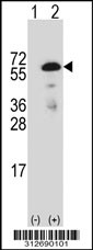 Western blot analysis of his-tag F11 (arrow) using his tag antibody. 293T cell lysates (2 ug/lane) either nontransfected (Lane 1) or transiently transfected with the F11 gene