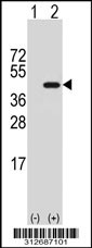 Western blot analysis of his-tag DNAJB1 (arrow) using his tag antibody. 293T cell lysates (2 ug/lane) either nontransfected (Lane 1) or transiently transfected with the DNAJB1 gene
