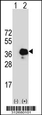 Western blot analysis of his-tag HNRNPA1 (arrow) using his tag antibody. 293T cell lysates (2 ug/lane) either nontransfected (Lane 1) or transiently transfected with the HNRNPA1 gene