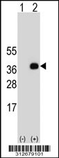 Western blot analysis of his-tag HMX2 (arrow) using his tag antibody. 293T cell lysates (2 ug/lane) either nontransfected (Lane 1) or transiently transfected with the HMX2 gene