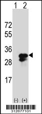 Western blot analysis of his-tag HMGB1 (arrow) using his tag antibody. 293T cell lysates (2 ug/lane) either nontransfected (Lane 1) or transiently transfected with the LGALS20 gene