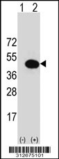 Western blot analysis of his-tag HLA-F (arrow) using his tag antibody. 293T cell lysates (2 ug/lane) either nontransfected (Lane 1) or transiently transfected with the HLA-F gene