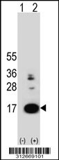 Western blot analysis of his-tag HBQ1 (arrow) using his tag antibody. 293T cell lysates (2 ug/lane) either nontransfected (Lane 1) or transiently transfected with the HBQ1 gene