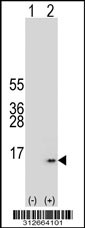 Western blot analysis of his-tag GYPB (arrow) using his tag antibody. 293T cell lysates (2 ug/lane) either nontransfected (Lane 1) or transiently transfected with the GYPB gene