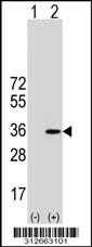 Western blot analysis of his-tag GTF2E2 (arrow) using his tag antibody. 293T cell lysates (2 ug/lane) either nontransfected (Lane 1) or transiently transfected with the GTF2E2 gene