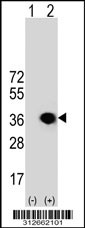 Western blot analysis of his-tag GTF2B (arrow) using his tag antibody. 293T cell lysates (2 ug/lane) either nontransfected (Lane 1) or transiently transfected with the GTF2B gene