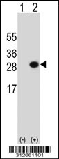 Western blot analysis of his-tag GSTT2 (arrow) using his tag antibody. 293T cell lysates (2 ug/lane) either nontransfected (Lane 1) or transiently transfected with the GSTT2 gene