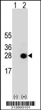 Western blot analysis of his-tag GSTA3 (arrow) using his tag antibody. 293T cell lysates (2 ug/lane) either nontransfected (Lane 1) or transiently transfected with the GSTA3 gene