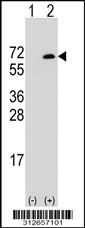 Western blot analysis of his-tag GPS1 (arrow) using his tag antibody. 293T cell lysates (2 ug/lane) either nontransfected (Lane 1) or transiently transfected with the GPS1 gene