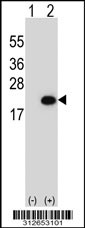 Western blot analysis of his-tag GPLD1 (arrow) using his tag antibody. 293T cell lysates (2 ug/lane) either nontransfected (Lane 1) or transiently transfected with the LGALS19 gene