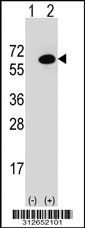 Western blot analysis of his-tag GPC5 (arrow) using his tag antibody. 293T cell lysates (2 ug/lane) either nontransfected (Lane 1) or transiently transfected with the GPC5 gene