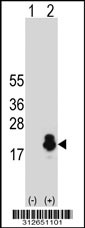 Western blot analysis of his-tag GP9 (arrow) using his tag antibody. 293T cell lysates (2 ug/lane) either nontransfected (Lane 1) or transiently transfected with the GP9 gene