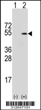 Western blot analysis of his-tag GLRA2 (arrow) using his tag antibody. 293T cell lysates (2 ug/lane) either nontransfected (Lane 1) or transiently transfected with the GLRA2 gene