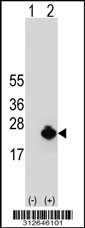 Western blot analysis of his-tag GIP (arrow) using his tag antibody. 293T cell lysates (2 ug/lane) either nontransfected (Lane 1) or transiently transfected with the GIP gene