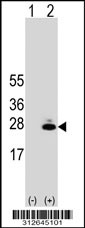 Western blot analysis of his-tag GH2 (arrow) using his tag antibody. 293T cell lysates (2 ug/lane) either nontransfected (Lane 1) or transiently transfected with the GH2 gene