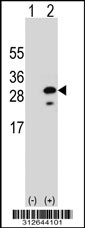 Western blot analysis of his-tag GGT1 (arrow) using his tag antibody. 293T cell lysates (2 ug/lane) either nontransfected (Lane 1) or transiently transfected with the GGT1 gene