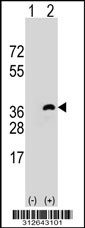 Western blot analysis of his-tag GFRA2 (arrow) using his tag antibody. 293T cell lysates (2 ug/lane) either nontransfected (Lane 1) or transiently transfected with the GFRA2 gene