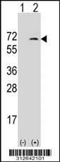 Western blot analysis of his-tag GCLC (arrow) using his tag antibody. 293T cell lysates (2 ug/lane) either nontransfected (Lane 1) or transiently transfected with the GCLC gene