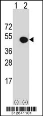 Western blot analysis of his-tag GC (arrow) using his tag antibody. 293T cell lysates (2 ug/lane) either nontransfected (Lane 1) or transiently transfected with the GC gene