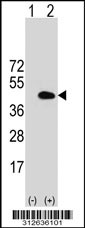 Western blot analysis of his-tag GABPB1 (arrow) using his tag antibody. 293T cell lysates (2 ug/lane) either nontransfected (Lane 1) or transiently transfected with the GABPB1 gene