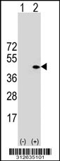 Western blot analysis of his-tag FUT6 (arrow) using his tag antibody. 293T cell lysates (2 ug/lane) either nontransfected (Lane 1) or transiently transfected with the FUT6 gene