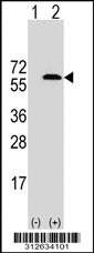 Western blot analysis of his-tag FUS (arrow) using his tag antibody. 293T cell lysates (2 ug/lane) either nontransfected (Lane 1) or transiently transfected with the FUS gene