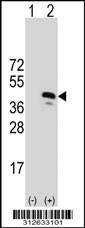 Western blot analysis of his-tag FOSL2 (arrow) using his tag antibody. 293T cell lysates (2 ug/lane) either nontransfected (Lane 1) or transiently transfected with the FOSL2 gene
