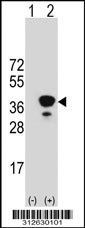 Western blot analysis of his-tag FGL1 (arrow) using his tag antibody. 293T cell lysates (2 ug/lane) either nontransfected (Lane 1) or transiently transfected with the FGL1 gene