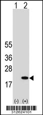 Western blot analysis of his-tag FABP5 (arrow) using his tag antibody. 293T cell lysates (2 ug/lane) either nontransfected (Lane 1) or transiently transfected with the FABP5 gene