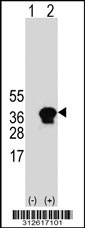 Western blot analysis of his-tag SFN (arrow) using his tag antibody. 293T cell lysates (2 ug/lane) either nontransfected (Lane 1) or transiently transfected with the SFN gene