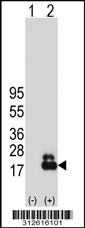 Western blot analysis of his-tag MLANA (arrow) using his tag antibody. 293T cell lysates (2 ug/lane) either nontransfected (Lane 1) or transiently transfected with the MLANA gene