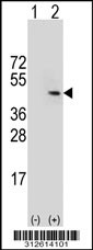 Western blot analysis of his-tag HNRNPC (arrow) using his tag antibody. 293T cell lysates (2 ug/lane) either nontransfected (Lane 1) or transiently transfected with the HNRNPC gene