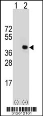 Western blot analysis of his-tag HMOX2 (arrow) using his tag antibody. 293T cell lysates (2 ug/lane) either nontransfected (Lane 1) or transiently transfected with the HMOX2 gene