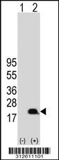 Western blot analysis of his-tag HMGN2 (arrow) using his tag antibody. 293T cell lysates (2 ug/lane) either nontransfected (Lane 1) or transiently transfected with the HMGN2 gene