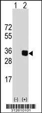Western blot analysis of his-tag HMGCL (arrow) using his tag antibody. 293T cell lysates (2 ug/lane) either nontransfected (Lane 1) or transiently transfected with the HMGCL gene