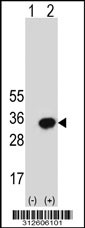 Western blot analysis of his-tag HLA-DPB1 (arrow) using his tag antibody. 293T cell lysates (2 ug/lane) either nontransfected (Lane 1) or transiently transfected with the HLA-DPB1 gene