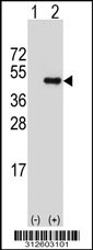 Western blot analysis of his-tag HLA-C (arrow) using his tag antibody. 293T cell lysates (2 ug/lane) either nontransfected (Lane 1) or transiently transfected with the HLA-C gene