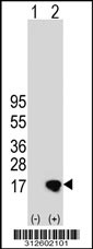 Western blot analysis of his-tag HBZ (arrow) using his tag antibody. 293T cell lysates (2 ug/lane) either nontransfected (Lane 1) or transiently transfected with the HBZ gene