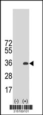 Western blot analysis of his-tag HRASLS5 (arrow) using his tag antibody. 293T cell lysates (2 ug/lane) either nontransfected (Lane 1) or transiently transfected with the HRASLS5 gene‘
