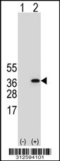 Western blot analysis of his-tag GTF2F2 (arrow) using his tag antibody. 293T cell lysates (2 ug/lane) either nontransfected (Lane 1) or transiently transfected with the GTF2F2 gene